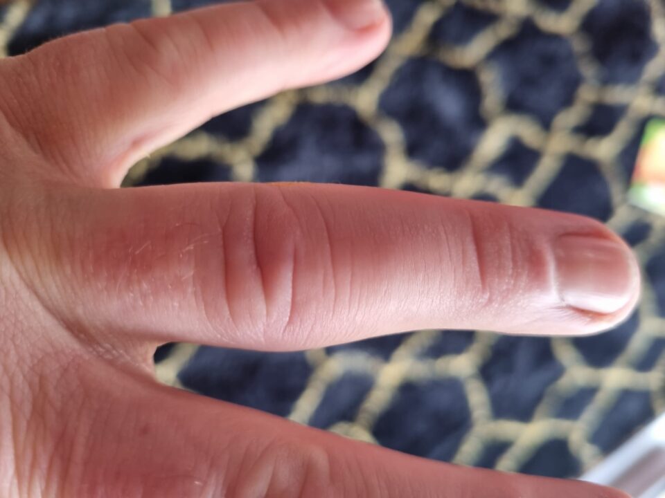 Close-up of a person's fingers against a black and beige patterned background.